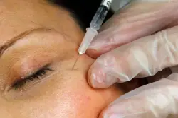 Feds warn on fake Botox